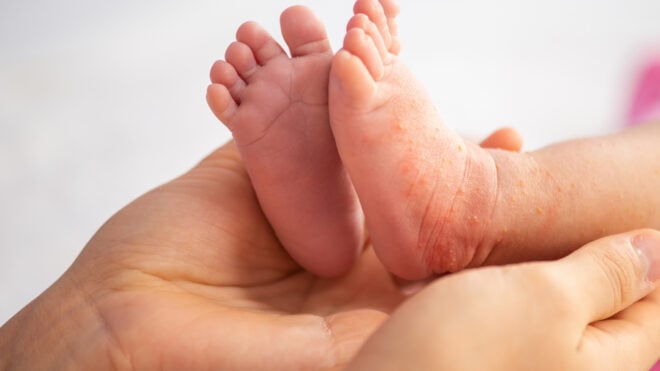 iStock-1205339054