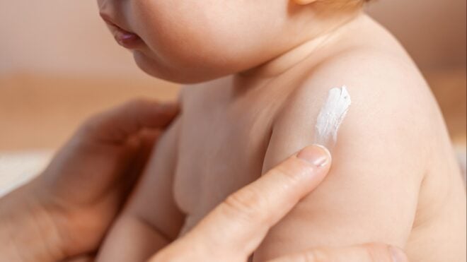 baby's skin